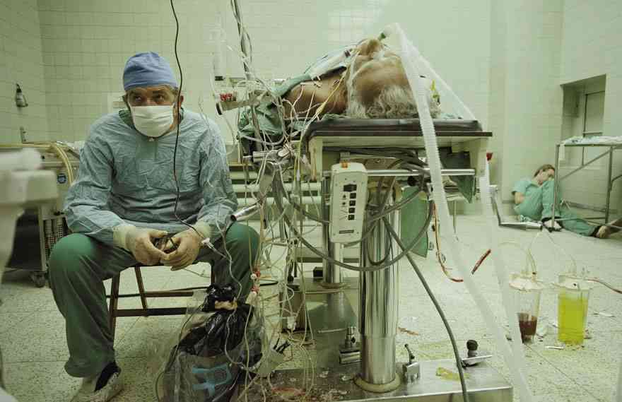 Surgeon And His Sleeping Assistant After 23 Hours Of Surgery Following A Successful Heart Transplant
