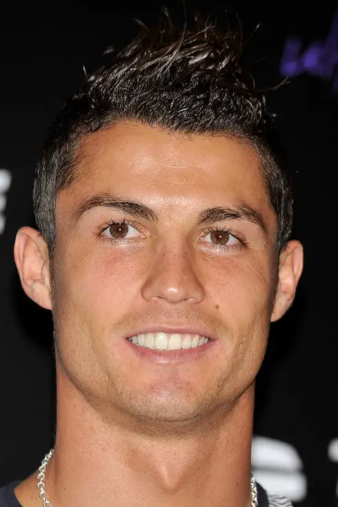 Cristiano Ronaldo with his teeth fixed