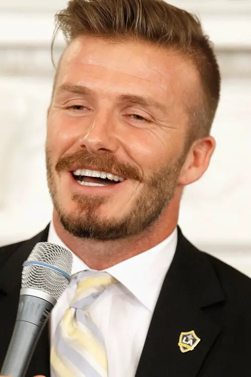 David Beckham Fixed Dentures