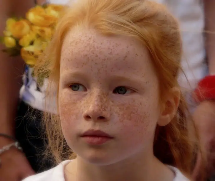 Face of a red-haired girl with freckles on her face 