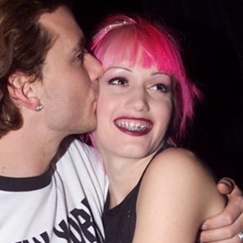 Gwen Stefani Unfixed Teeth