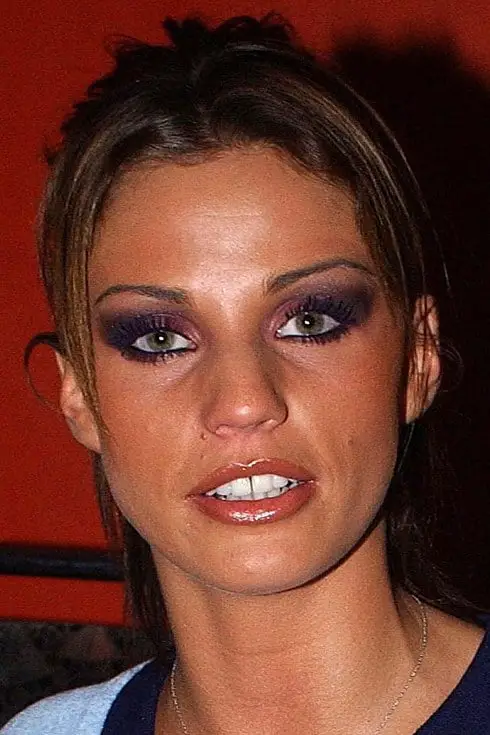 Katie Priece Before Fixing Her Teeth