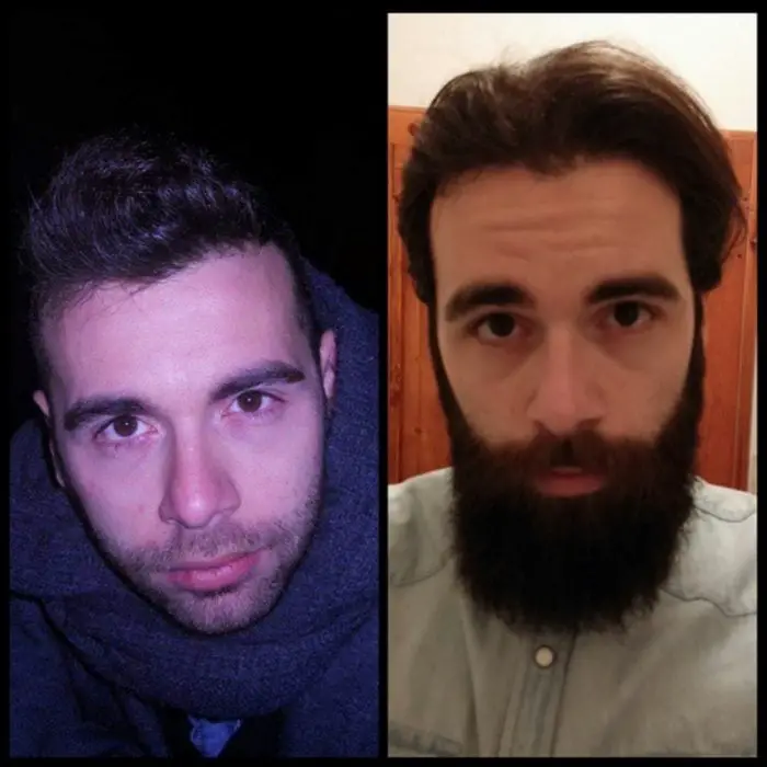 Man with and without beard 