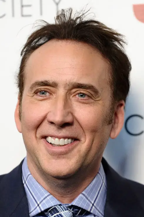 Nicolas Cage Fixed Teeth