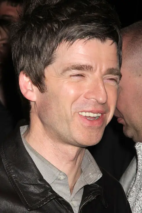 Noel Gallagher when he fixed his teeth