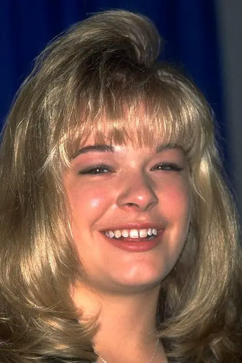 Read Rims Without Fixing Your Teeth