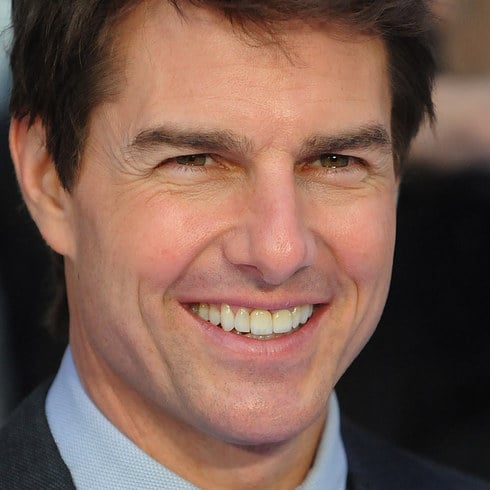 Tom Cruise Fixed Dentures