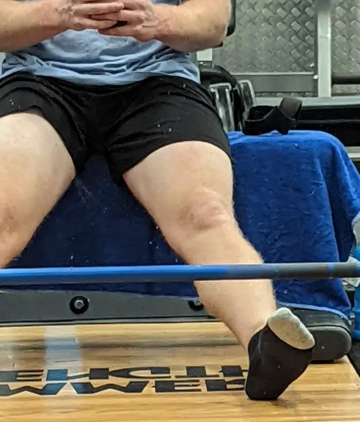 His Knee Creates An Impression Of A Face