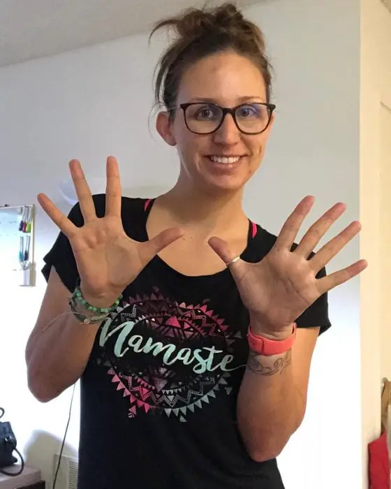 Abnormal parts of the body