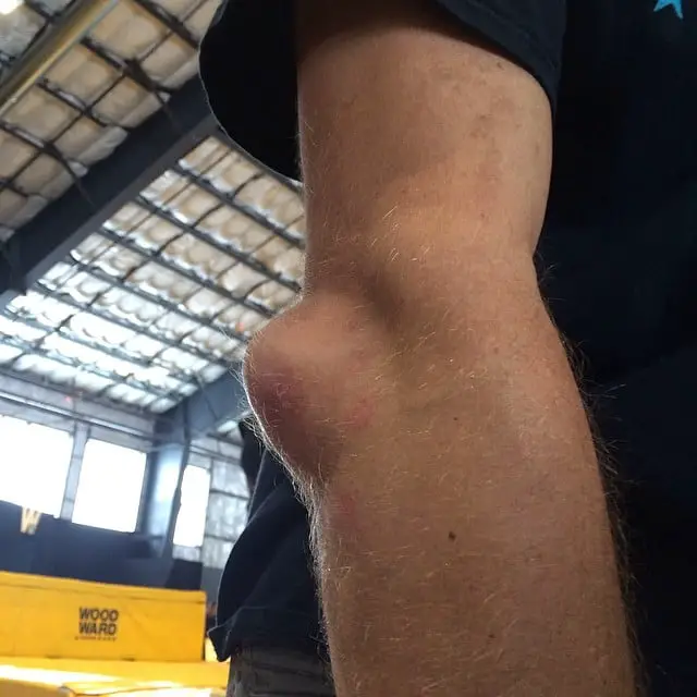 Abnormal parts of the body