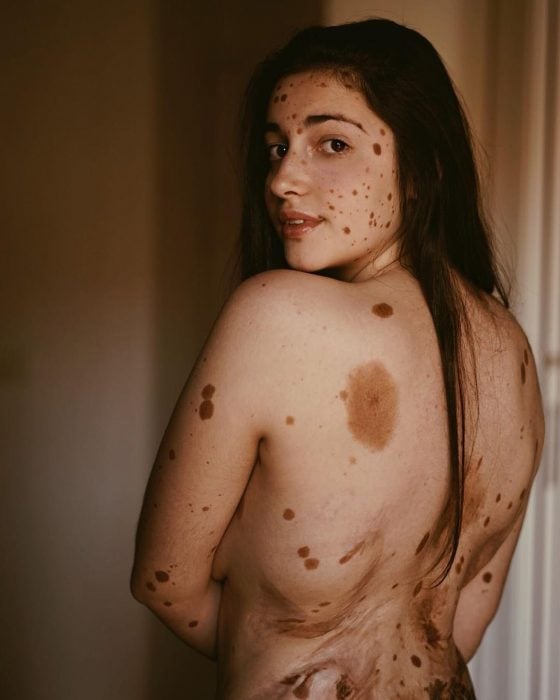 Abnormal parts of the body