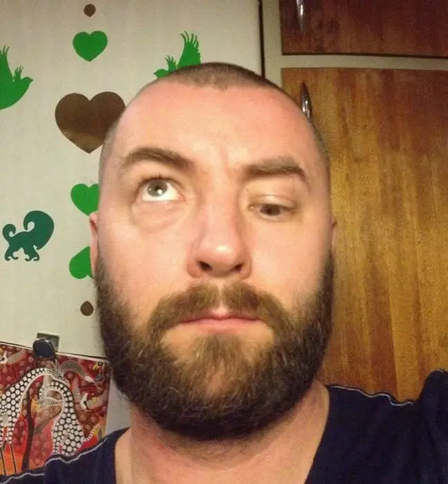 Abnormal parts of the body