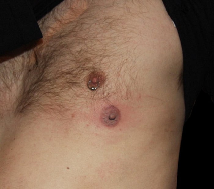 Abnormal parts of the body