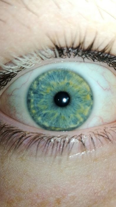 Abnormal parts of the body