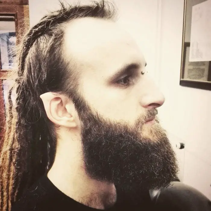 Abnormal parts of the body