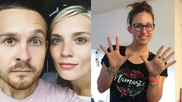 People Shared Photos Of Their Abnormalities